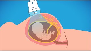 Advanced prenatal genetic testing