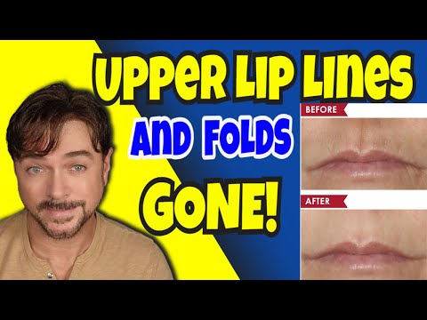 This Gets Rid Of Upper Lip Lines And Folds | Chris Gibson