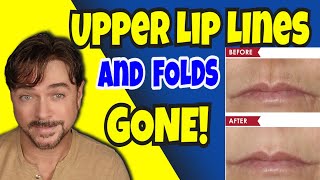 This Gets Rid Of Upper Lip Lines And Folds | Chris Gibson