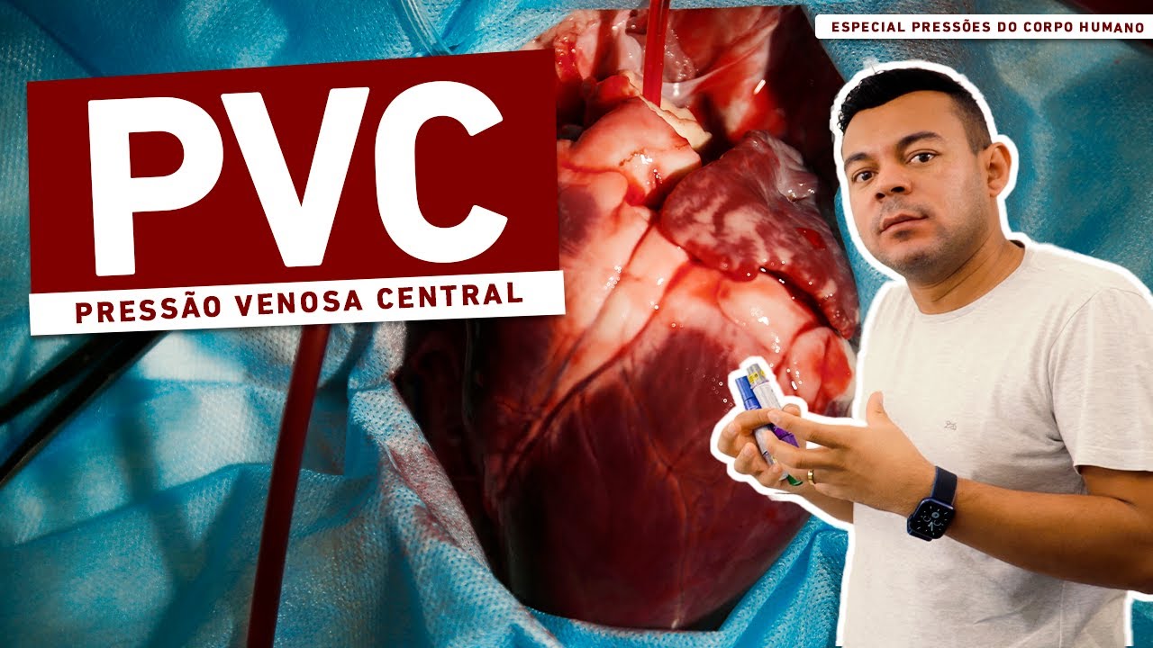 Pressão Venosa Central - PVC