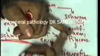 general pathology 33 : DR SAMEH GHAZY benign3&malig