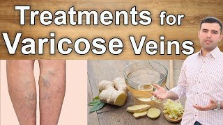Natural Cures for Varicose Veins – 10 Best Supplements, Herbs and Diets for Varicose