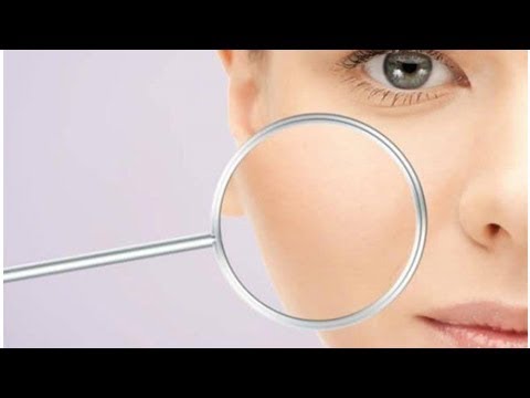 Le lentiggini come prendere il sole Comprare la crema di decolorazione di faccia di uomini