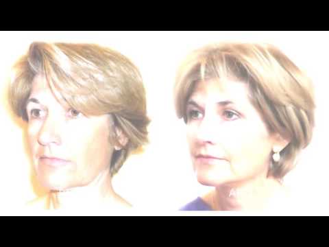 Silhouette Soft Clinic Video