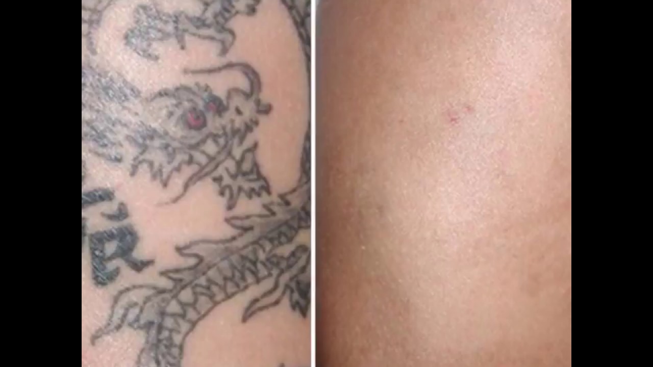 Alessandro Masellis-5