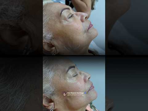 Testimonio real Lumiskin™ — ver en YouTube