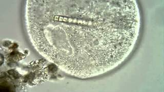 <em>Disematostoma minor</em>