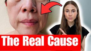 Why Skincare Can’t Fix Sagging Skin | Dermatologist Explain