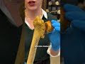 Exploring a non-union femoral neck ￼ fracture