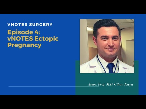 NOTES Ectopic