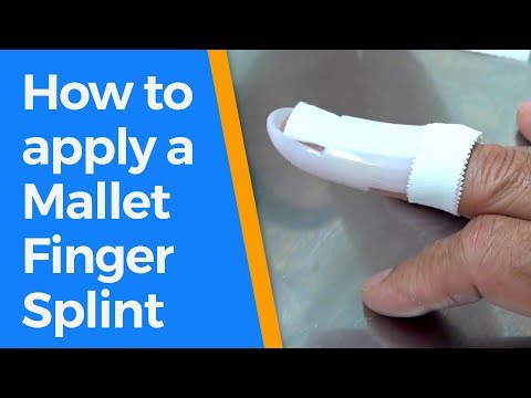 How to apply a mallet finger splint