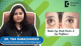 How to get rid of PUFFY EYES AND DARK CIRCLES ? - Dr.Tina Ramachander | Doctors