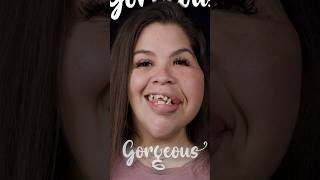 DENTAL IMPLANT MAKEOVER 🦷 | Smile Makeover #dentist #smiledental #dentalimplantsnearme #smile