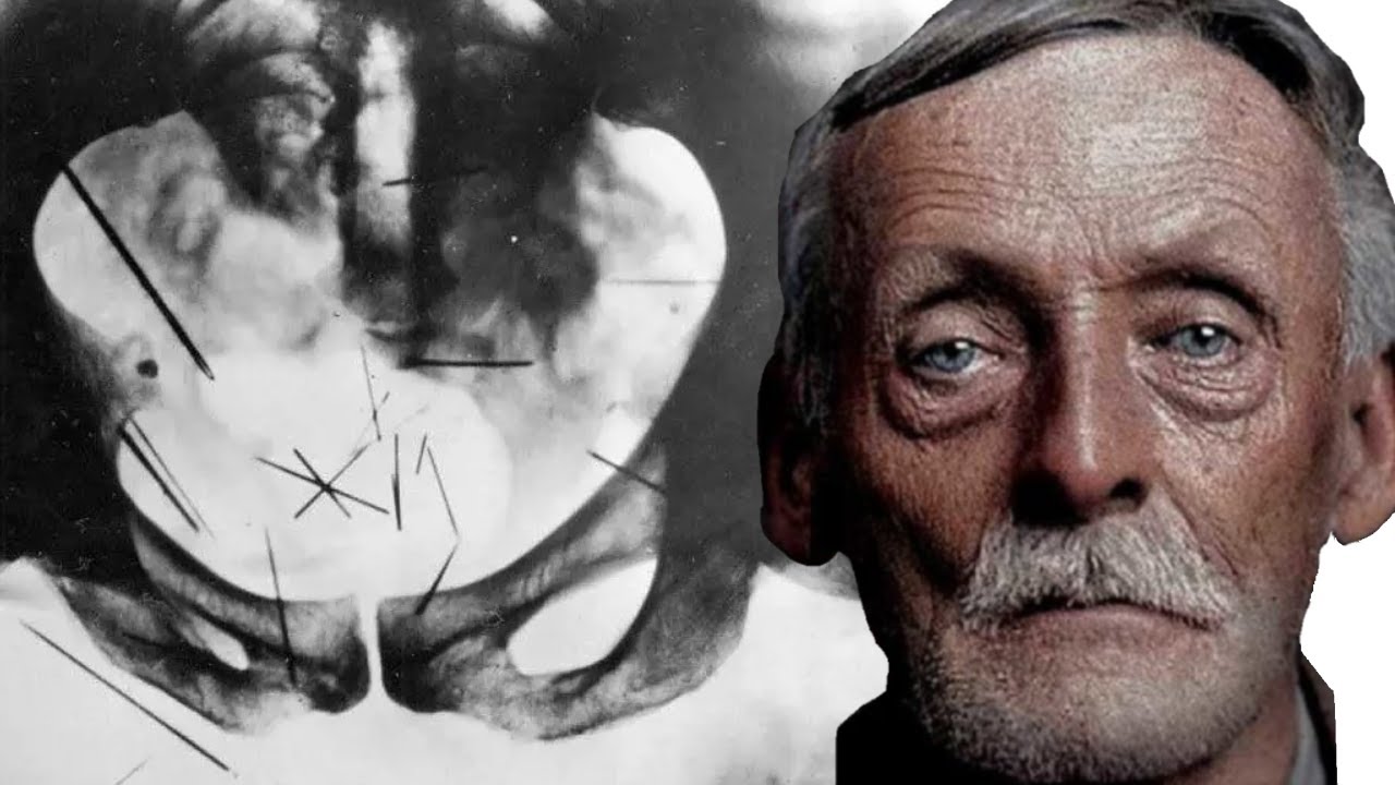 O LOBISOMEM DE WISTERIA - ALBERT FISH