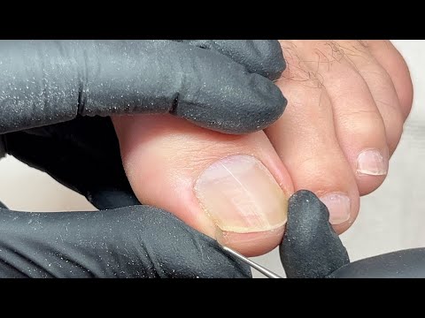 Guys want to have nice feet too! How I do basic dry pedicure