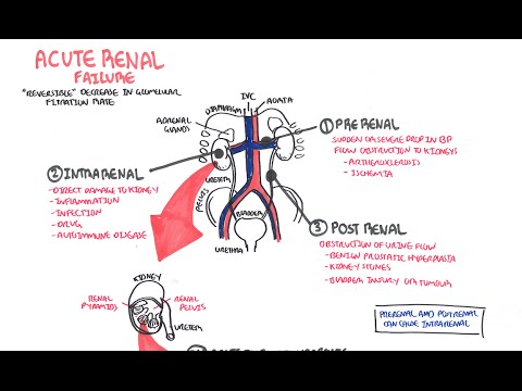 Acute Renal Failure