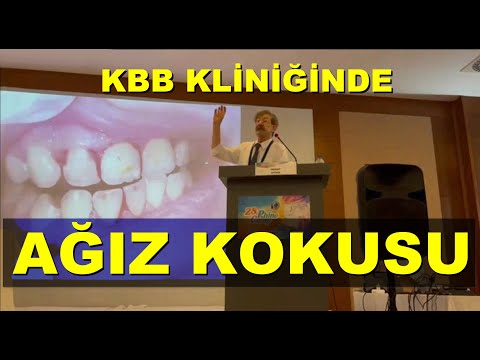 Kulak Burun Boğaz hekimlerine ağız kokusu konferans- Bodrum