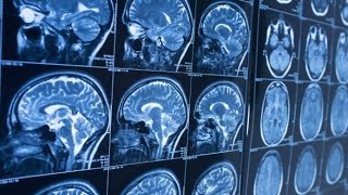 "Crown of Thorns" Discovered! The Secret To Overcoming Stress and Being Happy!