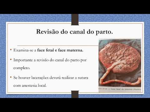 3º Período-dequitação da placenta. #cuidadosnoparto.