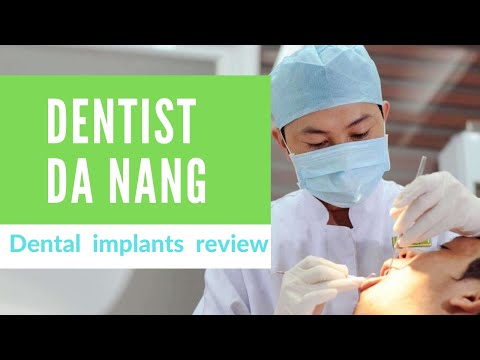 Dentists Da Nang: Dental Implants Review
