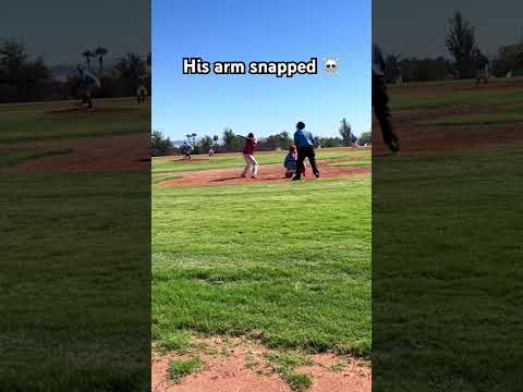 Pitcher’s arm snaps #shorts #baseball #pitching