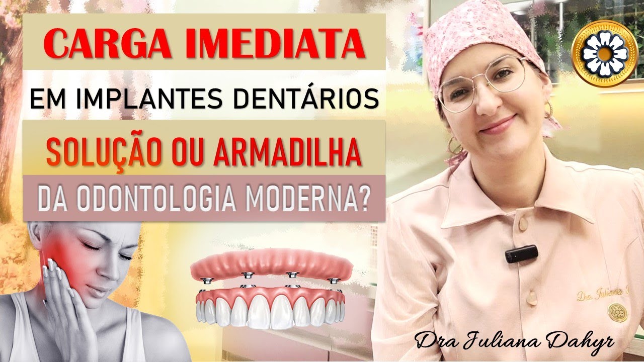 Carga imediata em implantes dentários: solução ou armadilha da odontologia moderna?