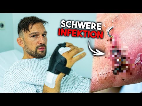 My hand is screwed... I need another emergency operation