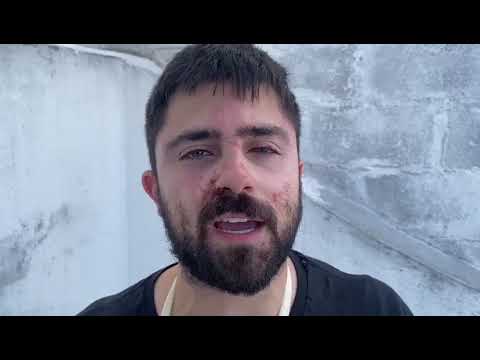 Integrante do MBL relata agressões sofridas na UFSC