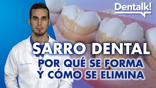 Dientes con SARRO - CÓMO QUITARLO y prevenirlo y por qué se forma el sarro dental | Dentalk! ©