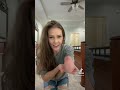 My amputated hand was what!? #amputee #bodypositivity