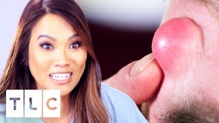 Brand New Dr. Pimple Popper! | 26th July At 9pm On TLC UK