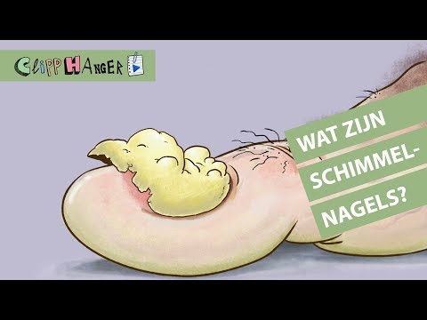 Wat zijn schimmelnagels?