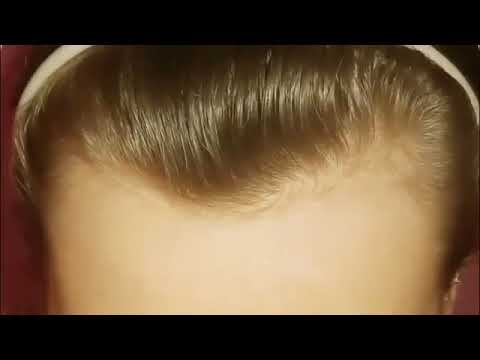 Czoło | Pastolektor Reuploading