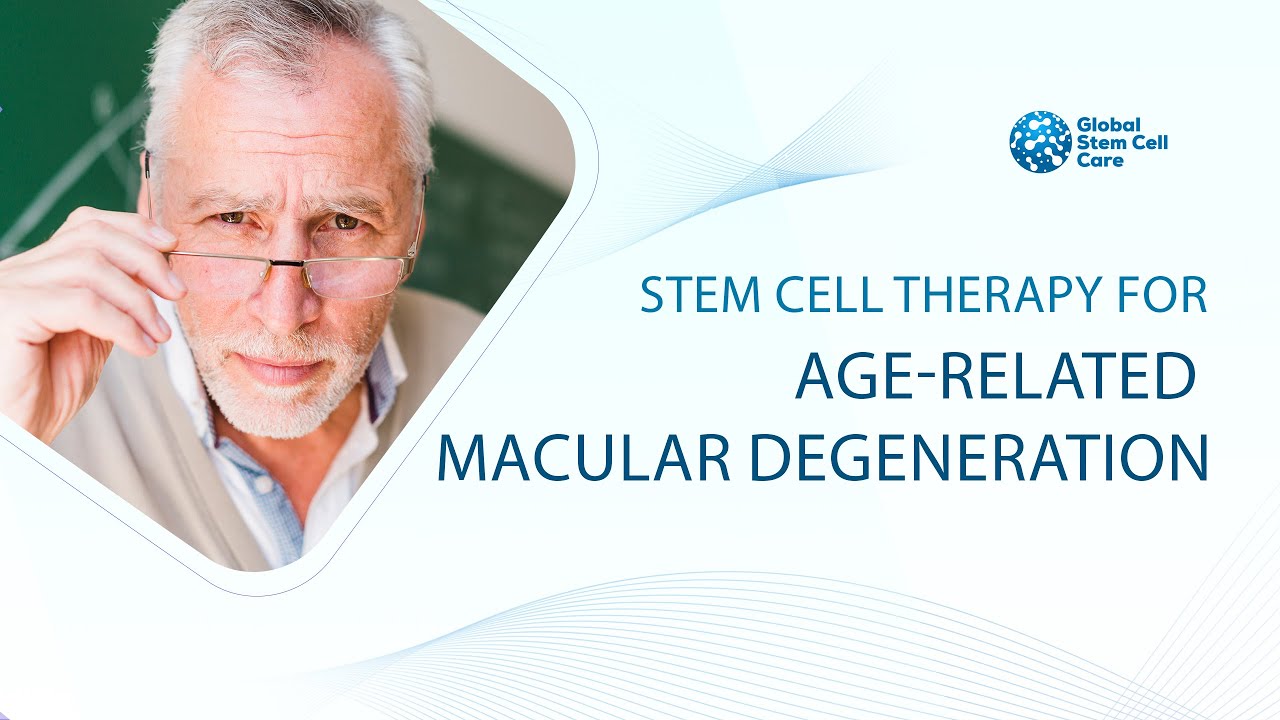 Age-Related Macular Degeneration | Affordable And Effective | Exosome Therapy | Stem Cell Therapy