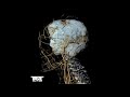 Rick Nizzy - We Are Not Made Of Sugar (MSM Remix) [TSTR002]