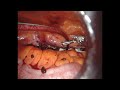 video thumbnail (4)