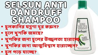 Dandruff Solution? Testing Selsun Anti Dandruff Shampoo!
