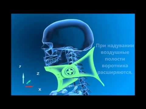 Прочность костей коленного сустава Прыщ который болит на спине