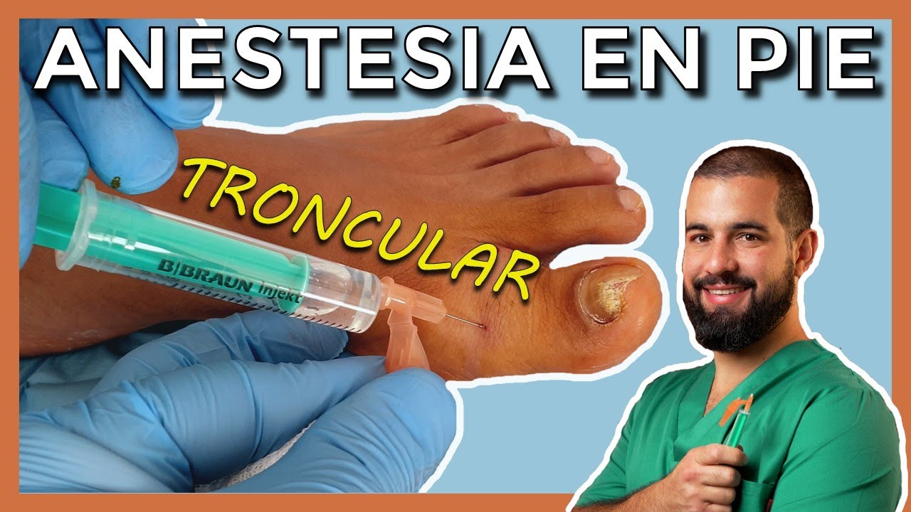Cómo anestesiar un DEDO DEL PIE. ANESTESIA TRONCULAR. Video REAL explicado