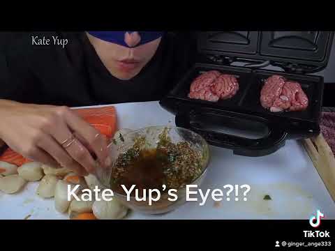 Kate Yup’s eye?