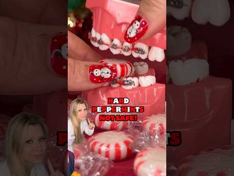 CANDY VS BRACES PEPPERMINT EDITION 🫣 WHAT CANDIES WILL BREAK THE BRACES OFF? REACTION #shorts
