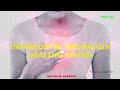 Sound Therapy Cell Regeneration Treatment Of Intercostal Neuralgia Frequency 802 Hz
