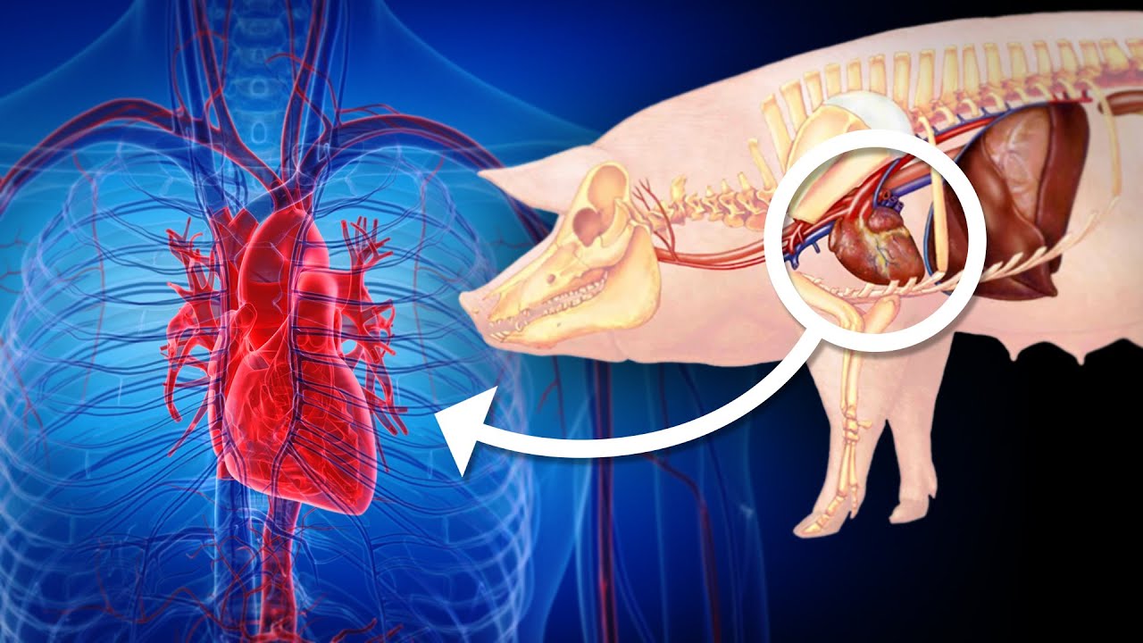 WORLD FIRST! A Literal Pig Heart Was Just Put Inside a 57-Year-Old Man