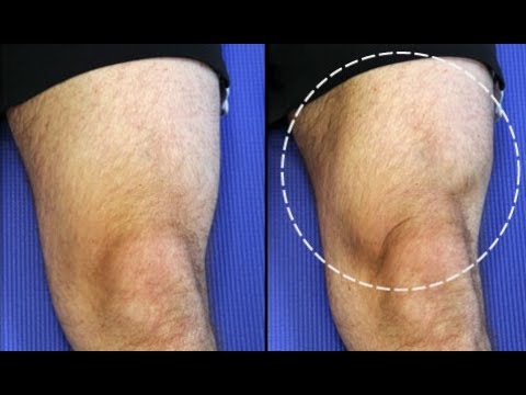 Hipnosis untuk menurunkan berat badan buku Download Yang memiliki produk untuk menghapus perut dan pinggul di rumah