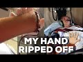 The Day I Almost Died // My Hand Ripped Off  *STORY TIME*