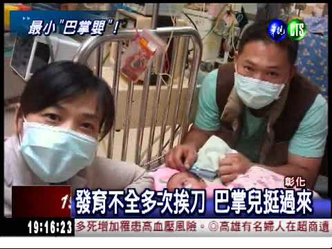 最小巴掌嬰長大了! 天使回家過年