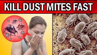 How to Get Rid of Dust Mites in Your House, Bed & Carpet Naturally