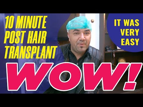 MedLinks hair transplant Patient from USA