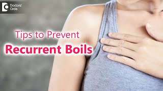 6 Things to know about Recurrent Boils or Furunculosis & treatment-Dr. Divya Sharma|Doctors