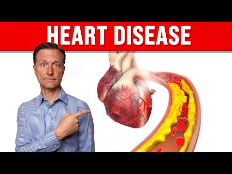 Weird Symptoms Explained by Dr Berg